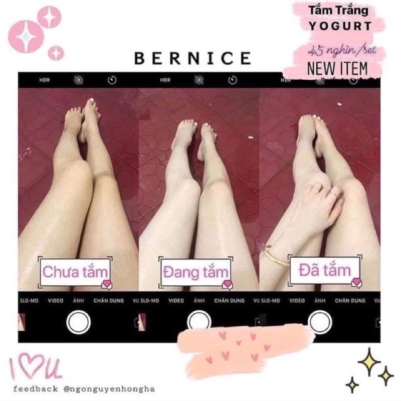 Tắm Trắng BERNICE   - HÀNG CHÍNH HÃNG CÔNG TY 100% | BigBuy360 - bigbuy360.vn