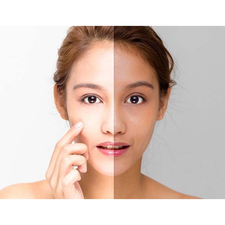 Viên uống trắng da giảm nám tàn nhang Alpha lipoc acid 1000mg độ tinh khiết 99% chống lão hóa, cân bằng lượng đườntoniiq