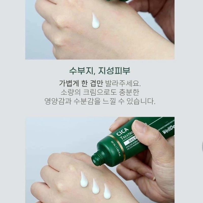 Kem dưỡng phục hồi làm dịu da B5 Cica Treatment Repair Daily Cream Wellderma Hàn Quốc