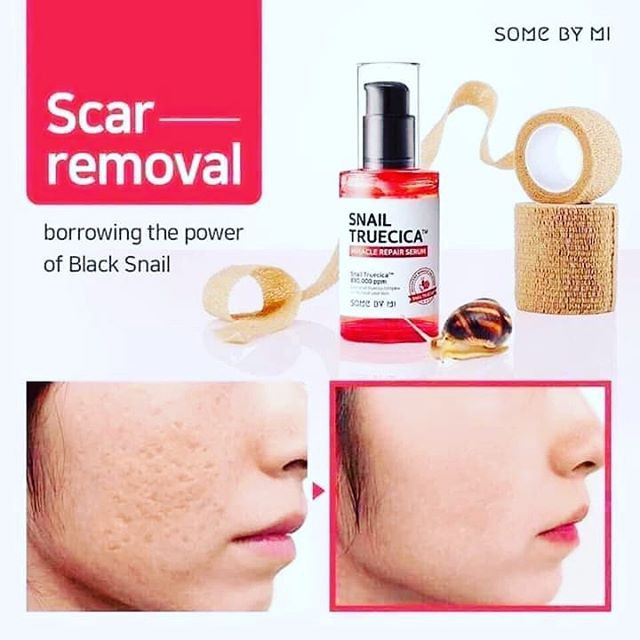 SET DƯỠNG SOME BY MI SNAIL TRUECICA MIRACLE REPAIR STARTER KIT-EDITION