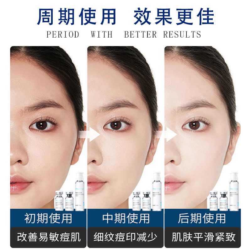 Ehrlich tinh chất oligopeptide phục hồi làm trắng da hỗ trợ giảm mụn dưỡng ẩm làm trắng da | BigBuy360 - bigbuy360.vn