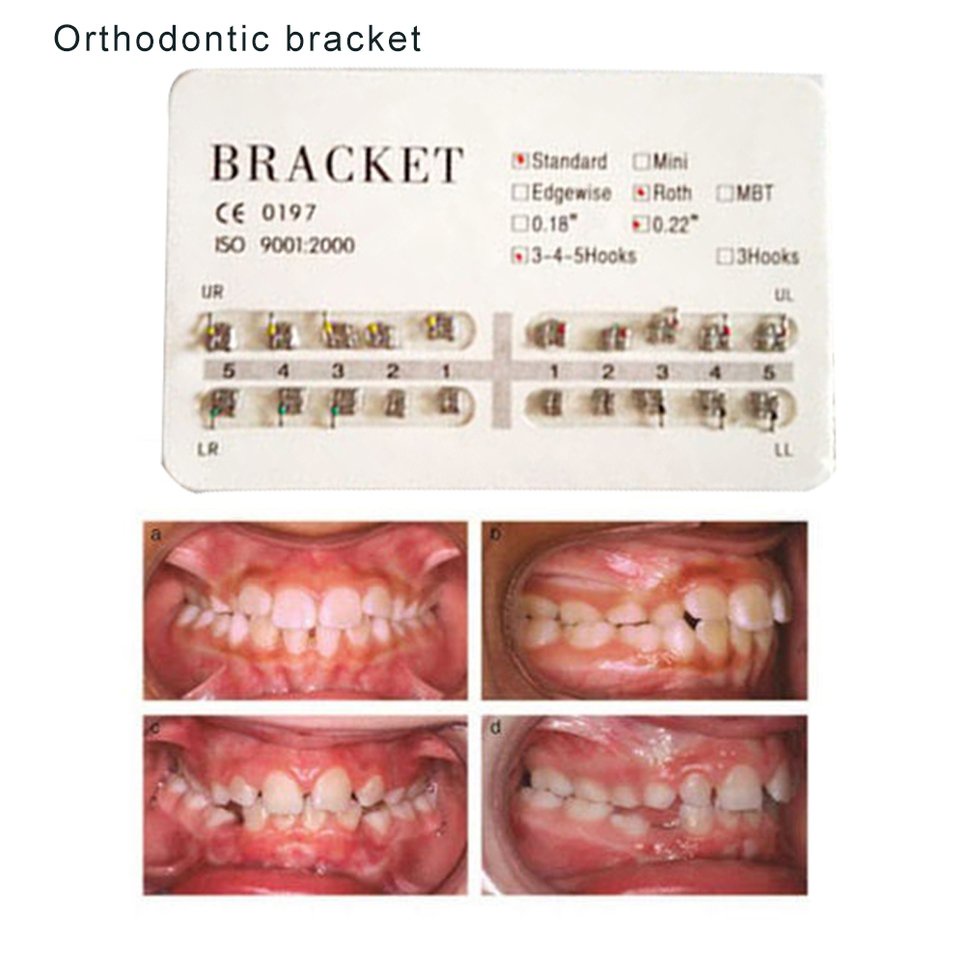 Standard Durable Dental Orthodontic Brackets Teeth Use Braces Standard