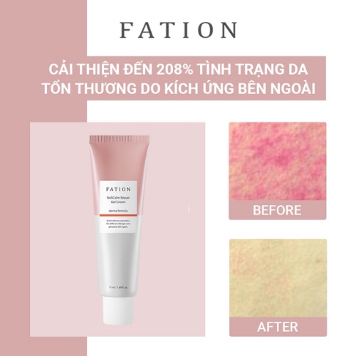 Kem Dưỡng Dạng Gel Phục Hồi Da FATION NoSCalm Repair Gel Cream