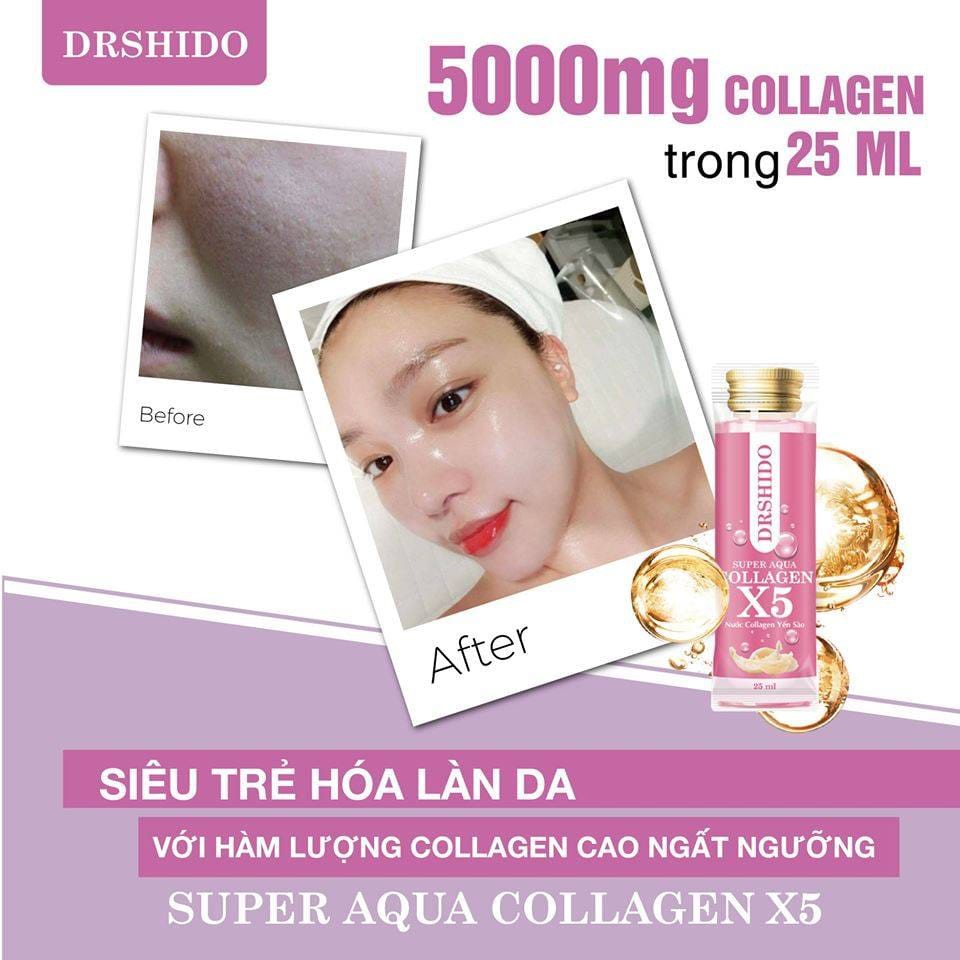 NƯỚC COLLAGEN YẾN XÀO - SUPER AQUA COLLAGEN X5