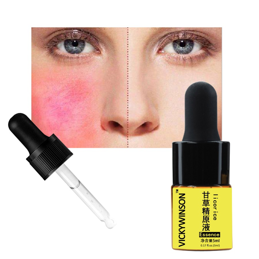 Tinh Chất Licorice Chiết Xuất Thực Vật Dạng Lỏng Loại Bỏ Mụn Dung Tích 5ml