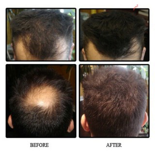 [Bán Sỉ] Bột phủ dày tóc Toppik Hair