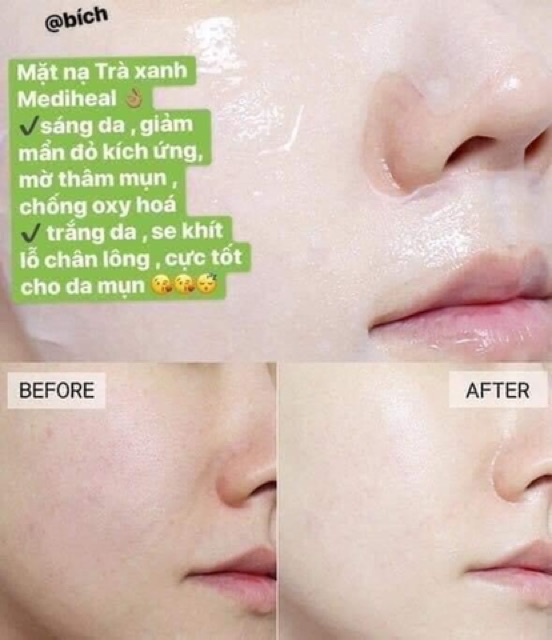 Mặt nạ Mediheal Mask Pack mẫu mới