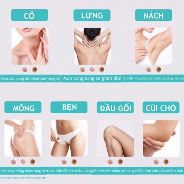 NAKIZ LIVELY BUTT 〡 Kem thoa thâm, mụn Mông, Bẹn, Nách, Lưng, Nhũ hoa, Cùi chỏ, Đầu gối .... Thái Lan