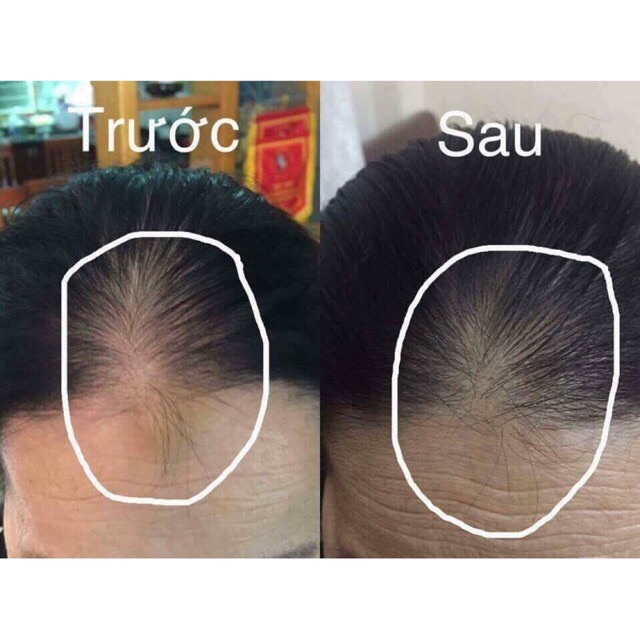 Tinh dầu bưởi rừng THH  💕phiên bản mới X5 đậm đặc💕