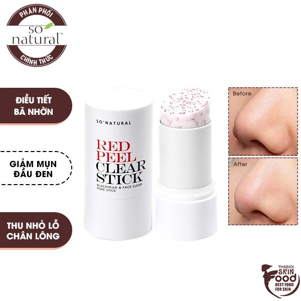 Thanh Lăn Hỗ Trợ Giảm Mụn Đậu Đen, Điều Tiết Bã Nhờn So' Natural Red Peel Clear Stick 23g