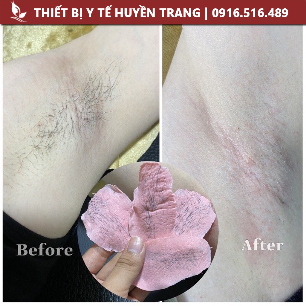 Sáp Wax Lông Hạt Đậu Hard Beans Nhập Khẩu Dùng Tẩy Lông Tại Nhà Y Tế Huyền Trang