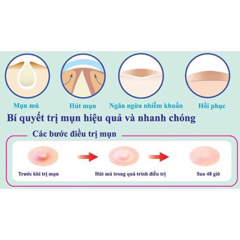 Miếng Dán Mụn Cấp Tốc Mayan Care - Hồng - Xanh