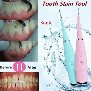 Dụng cụ lấy cao răng tại nhà sonicpic - máy hút cao răng - máy sạc pin