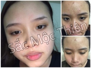 Mặt Nạ Thải Độc