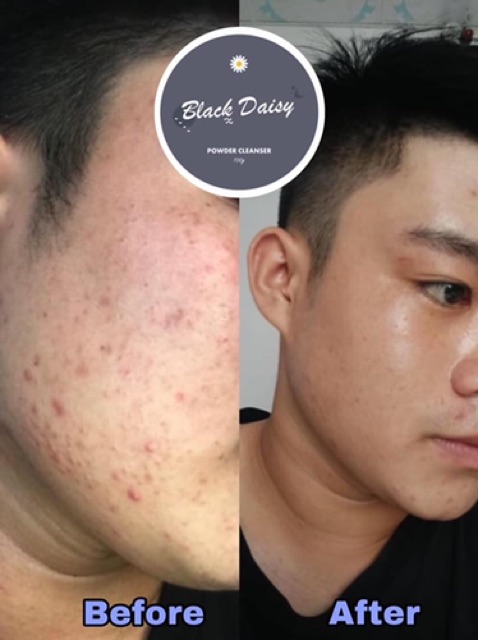 [FreeshipXtra]Bột rữa mặt Black Daisy-64 loại thảo mộc thiên nhiên+kèm xẻng và bọt biển rữa mặt | BigBuy360 - bigbuy360.vn