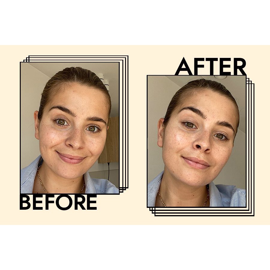 🏆 Tinh chất phục hồi chống lão hoá Estee Lauder Advanced Night Repair Synchronized Multi-Recovery Complex Serum