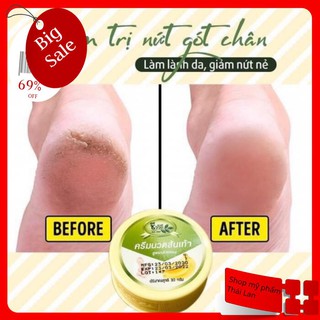 KEM TRỊ NỨT GÓT CHÂN CHUỐI 30g THÁI LAN CHÍNH HÃNG