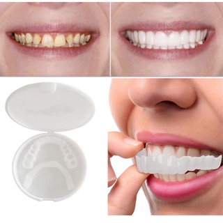 1 bộ vỏ bọc răng giả màu trắng dùng trong nha khoa - ảnh sản phẩm 3