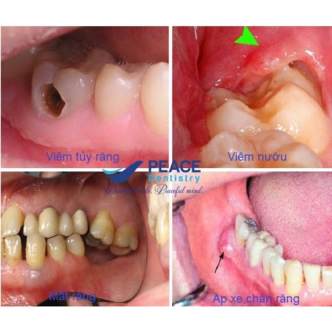 Kem Đánh Răng Nha Đam Lô Hội Forever Bright 028FLP