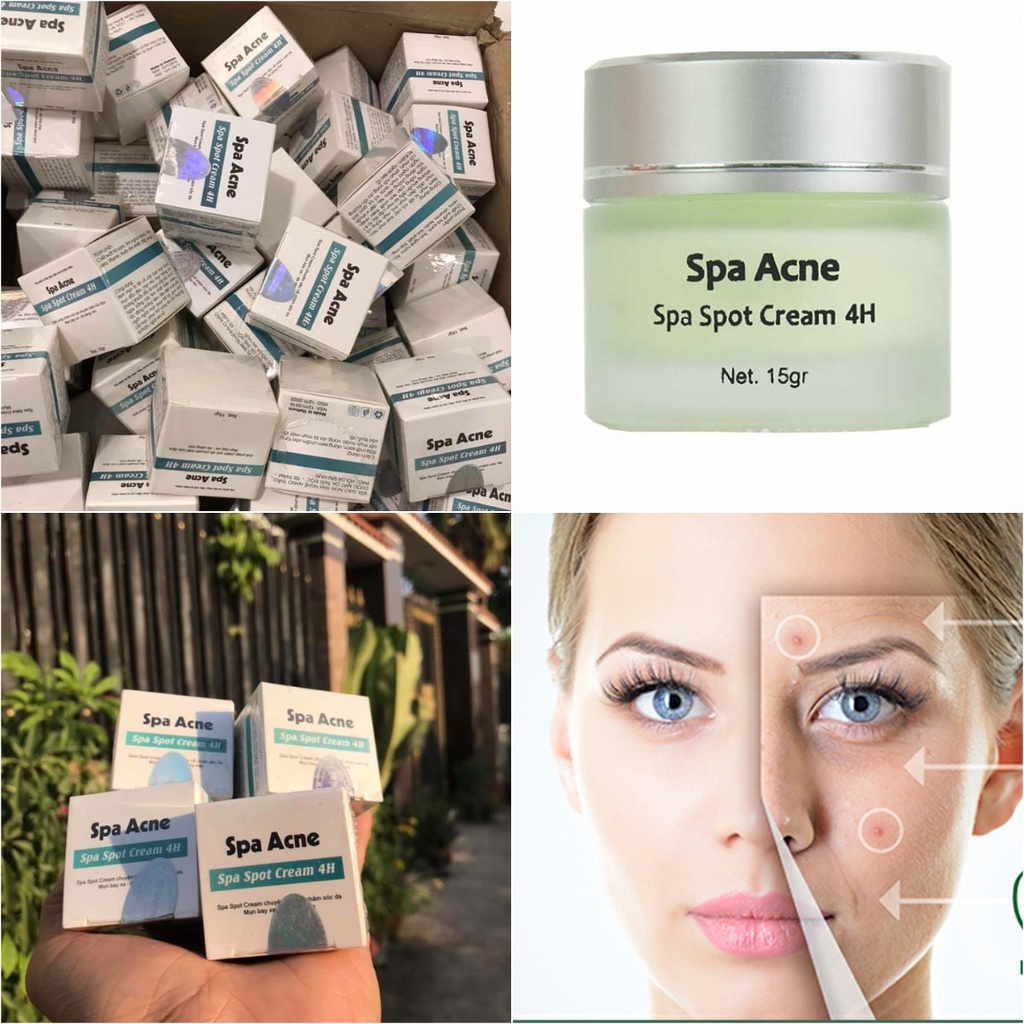 CHÍNH HÃNG Kem Giảm Mụn Ngừa Thâm Chính Hãng Spa Acne