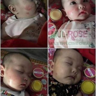 Kem đa năng mul rose