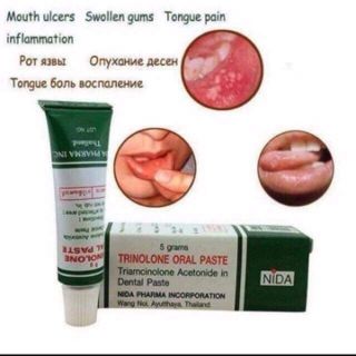 Kem trị nhiệt miệng Thái Lan