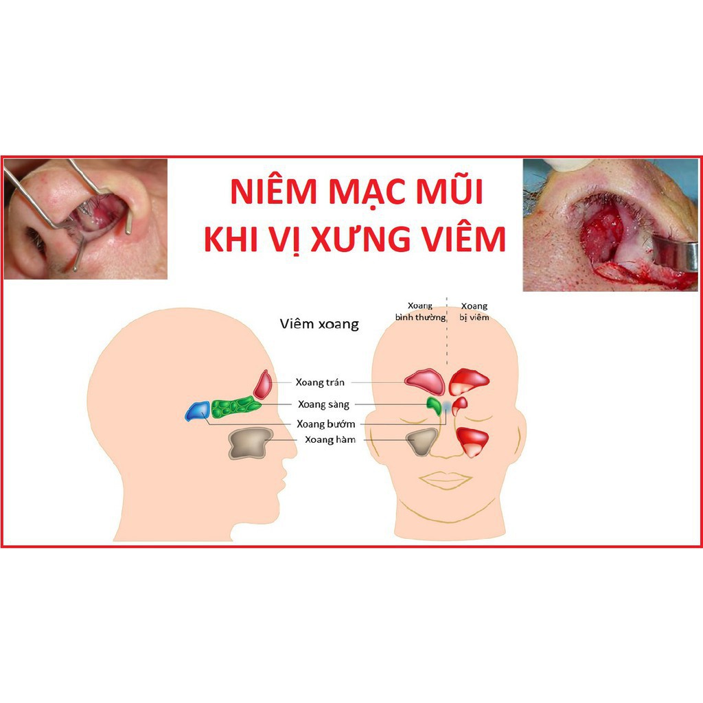 COMBO 50 GÓI MUỐI RỬA MŨI VSS (KIDS & ADULT) .