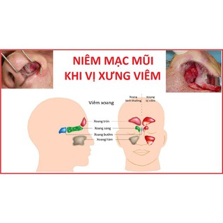 Combo 50 gói muối rửa mũi vss .