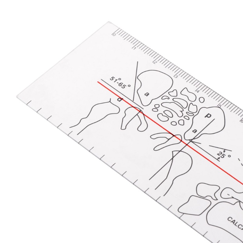 Thước đo góc y khoa chất liệu PVC