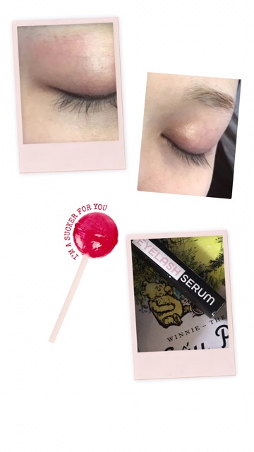 EYE LASH - DƯỠNG MI REVITALASH