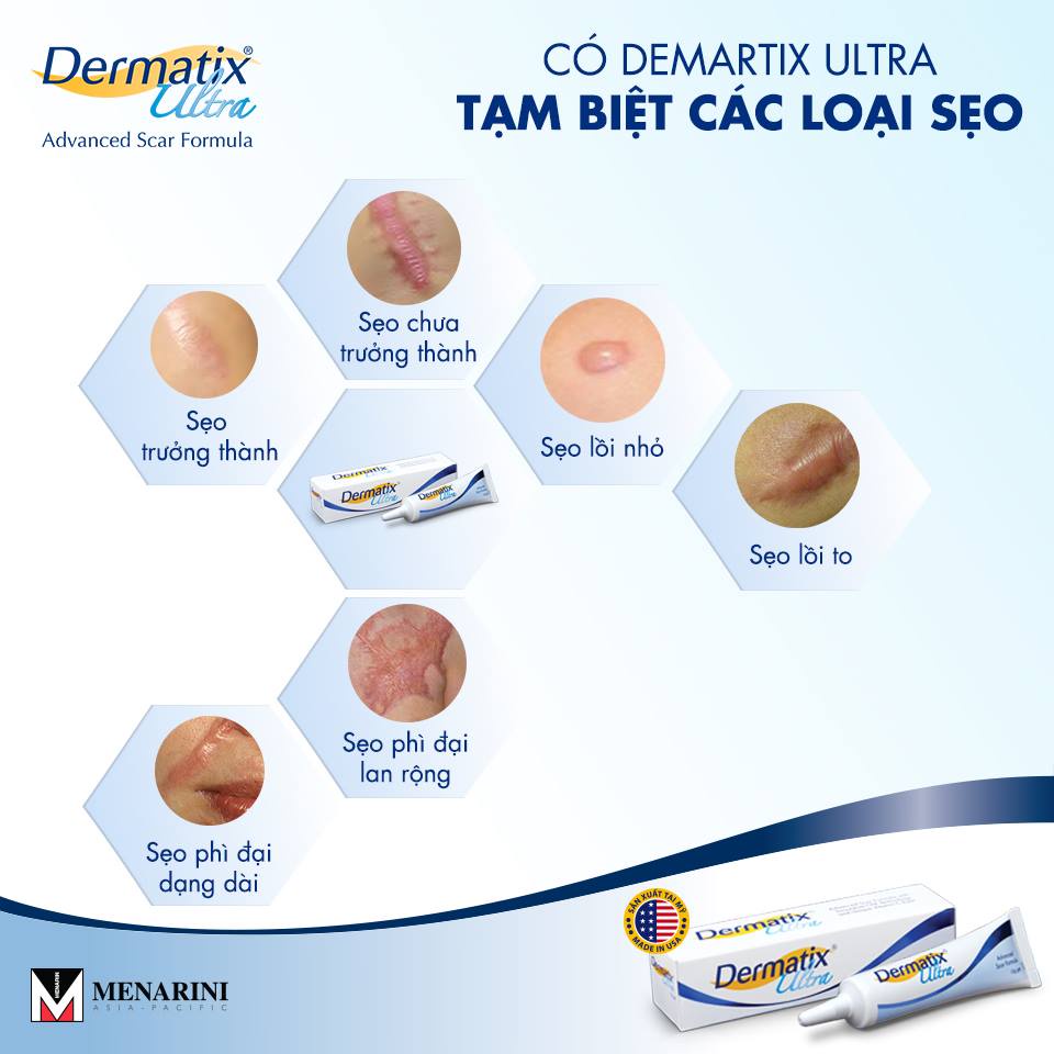 [CHÍNH HÃNG] Gel bôi làm mờ sẹo Dermatix Ultra Advanced Scar Formula giảm sẹo lồi, sẹo phì đại, sẹo mổ [dematix, derma]