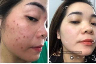 1 Hộp Kem ngày ( nâng cơ số 3) Baybela