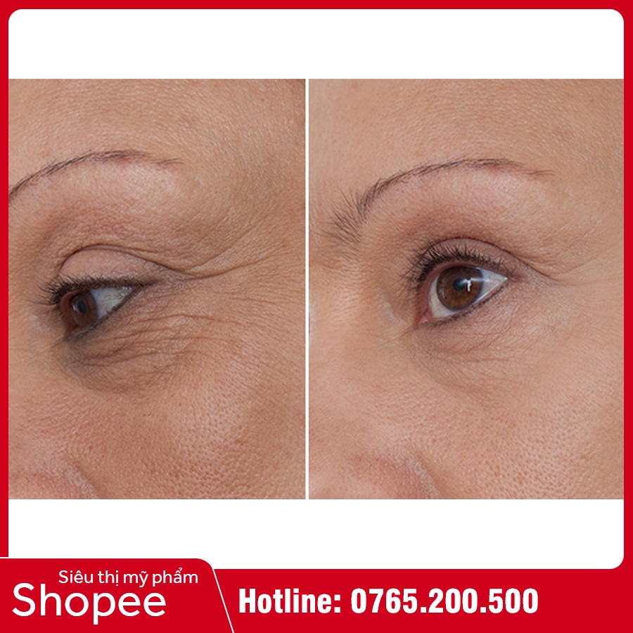 Kem Chống Lão Hóa Medi White - Medi Anging - Chống Nhăn, Tái Tạo Làn Da Săn Chắc | BigBuy360 - bigbuy360.vn