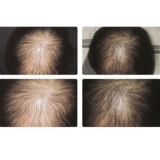 Tinh dầu bưởi kích thích mọc tóc, trị rụng tóc‎ Hair Lotion 100ml | BigBuy360 - bigbuy360.vn