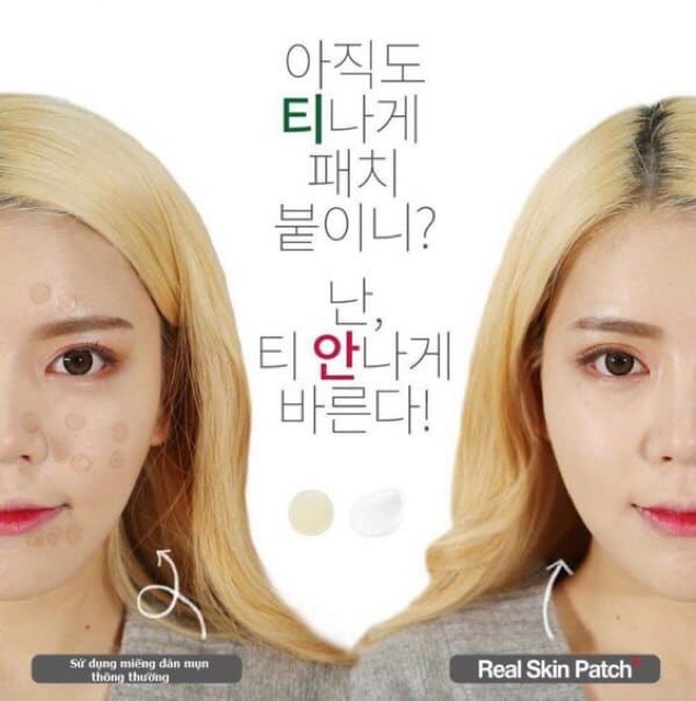 Gel Che Mụn Bảo Vệ Da Not4U Real Skin Patch