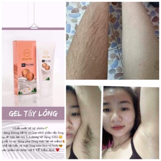 Gel tẩy lông Mamenshop