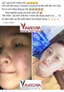 Combo Dược Mĩ Phẩm Vaurora
