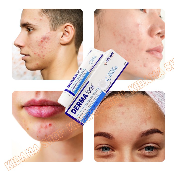 Gel MỤN Derma Forte giúp ngăn ngừa và giảm loại mụn trứng cá, mụn đầu đen, mụn đầu trắng mờ thâm liền sẹo | BigBuy360 - bigbuy360.vn