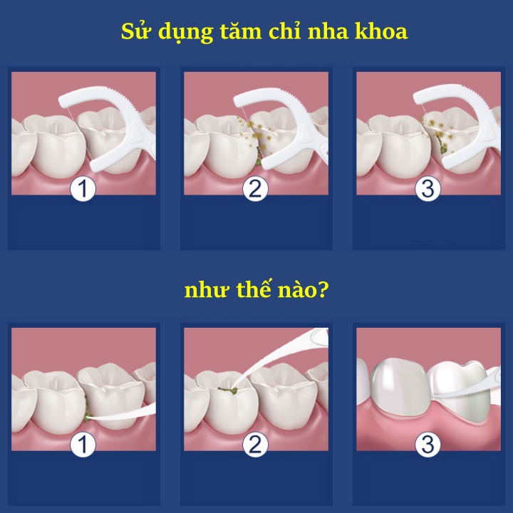 Tăm chỉ nha khoa siêu mảnh 100 cây cực bền Cacbon cao phân tử Fawnmum và hộp cá nhân