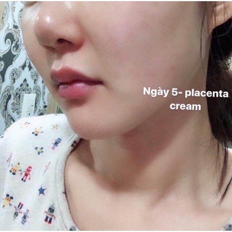 Kem Nhau Thai Vạn Năng Celes Placentary Cream