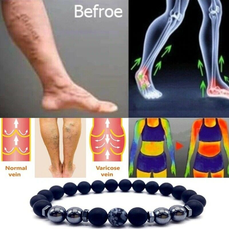 Vòng Đeo Tay Từ Tính Hỗ Trợ Giảm Đau Khớp Hiệu Quả