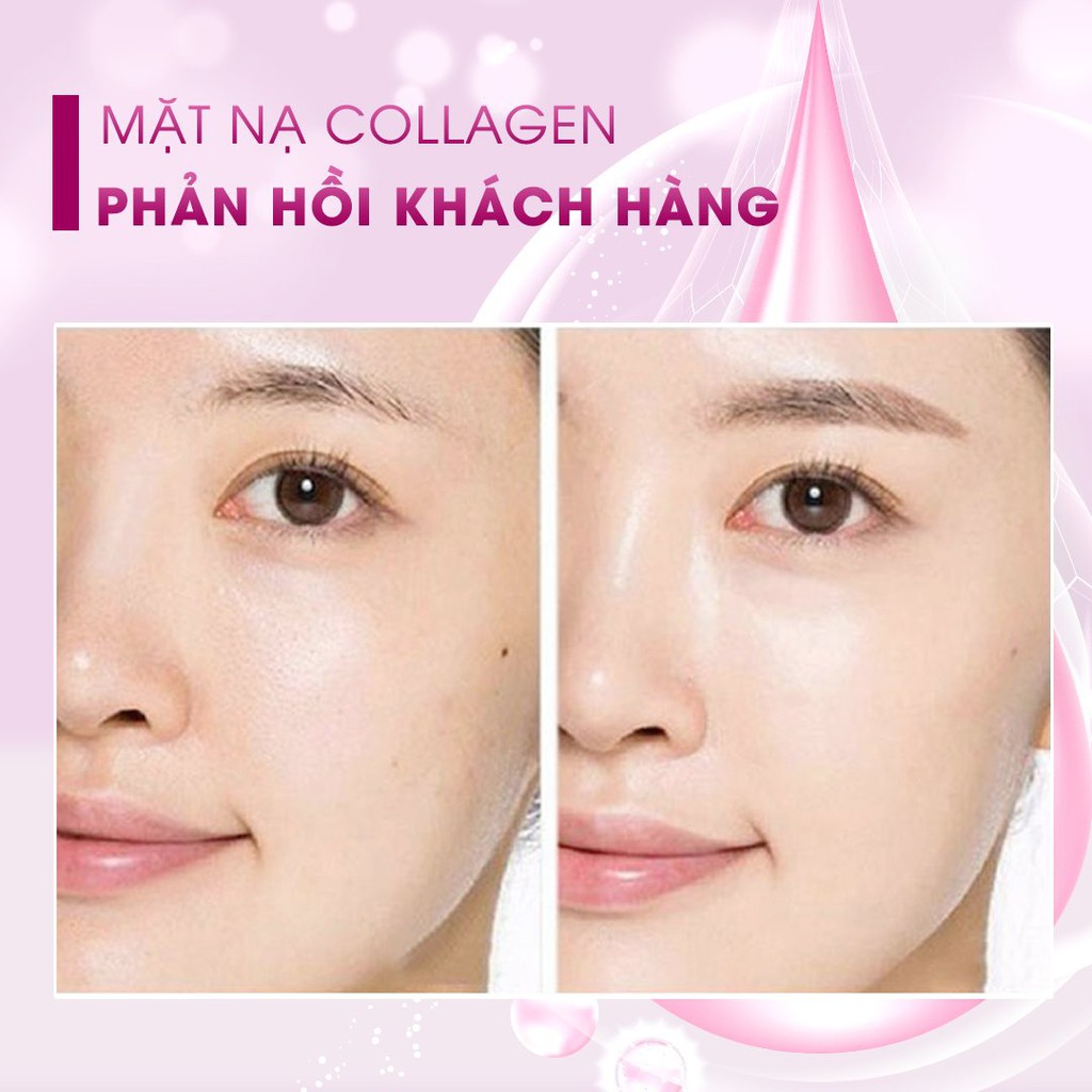 Y - Mặt nạ collagen thạch tinh thể pha lê phục hồi da chuyên sâu, mặt nạ dưỡng da ISKIN Hàn Quốc | Thế Giới Skin Care