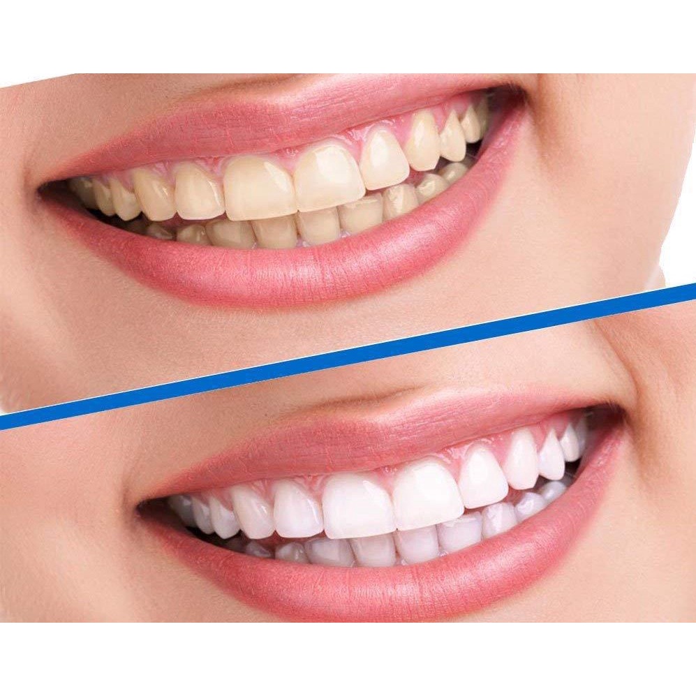 Miếng Dán Trắng Răng 3D White Teeth - Full Hộp 7 gói 14 miếng Tiện Dụng Chất Lượng Cao [CEC Store]