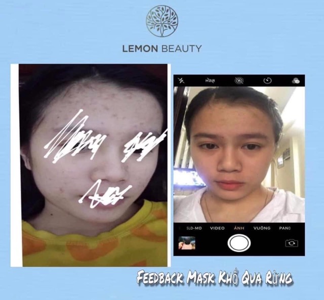 [MUA 1 TẶNG 4] - LEMON MASK KHỔ QUA RỪNG | BigBuy360 - bigbuy360.vn