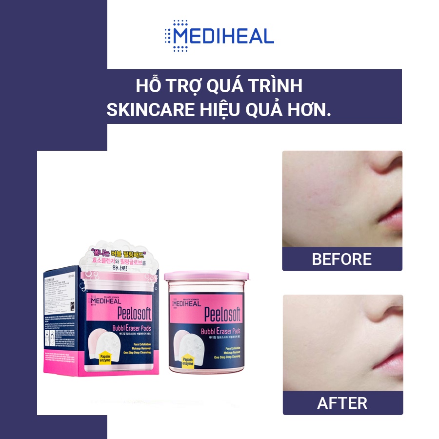 Hộp 20 Miếng Tẩy Tế Bào Chết Mediheal Peelosoft Bubbl Eraser Pads 20 pads