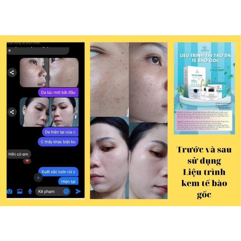 Kem Tái Tạo Tế Bào Gốc – Stem Cell Regenerating - ORENYA