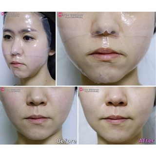MẶT NẠ THẠCH CELDERMA NINETALKS HYDROGEL MASK
