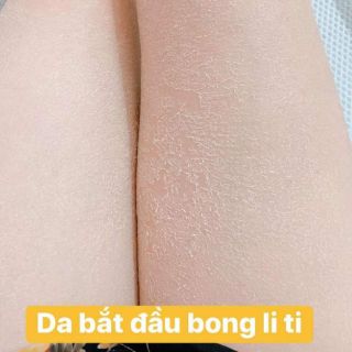 BODY TÁI TẠO DA HANDMADE