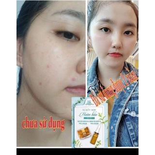 Kem Face Collagen X3 [Chính Hãng]