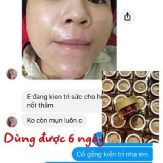 Cao mụn sâm đỏ